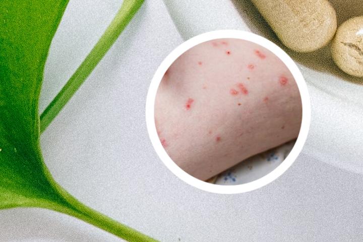 警察对牛皮癣的看法