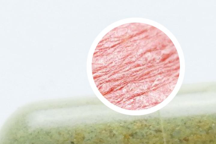 中国最新银屑病药膏维