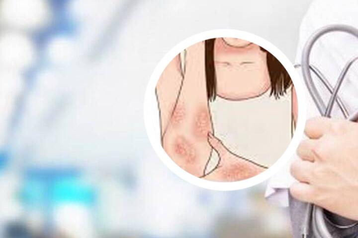 沈阳银屑病医院图片