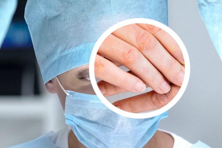 红皮型银屑病腿