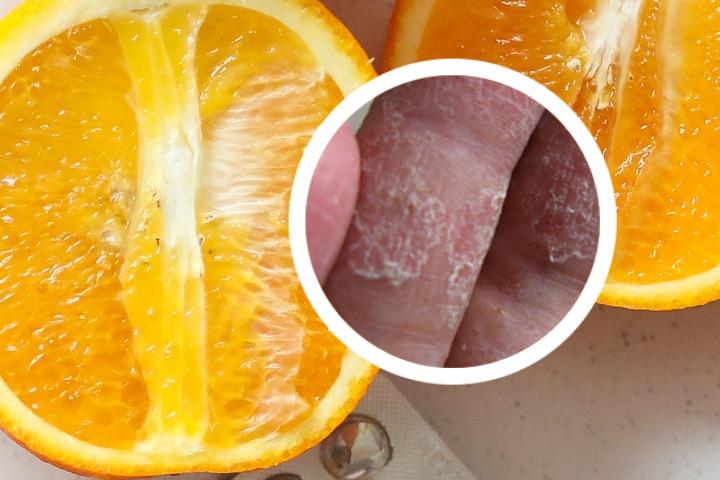 石家庄有治疗牛皮癣的吗