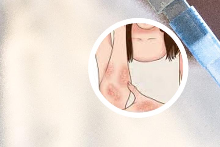 吃梨治牛皮癣吗