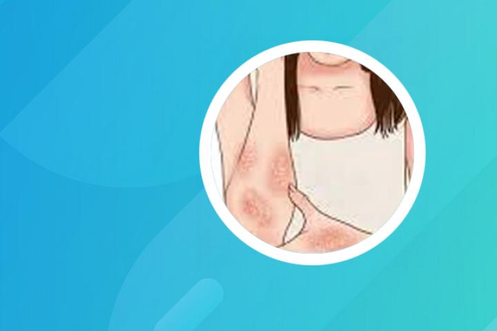 皮肤病血毒丸牛皮癣吃多久