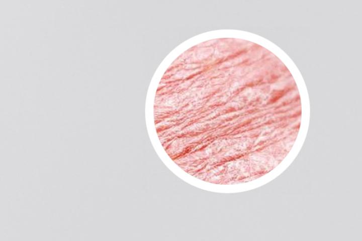 七岁小孩银屑病能治疗好吗