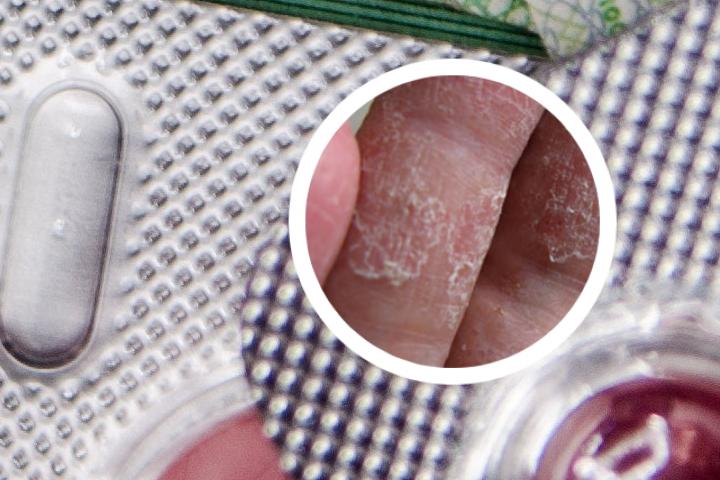 牛皮癣氨肽素片
