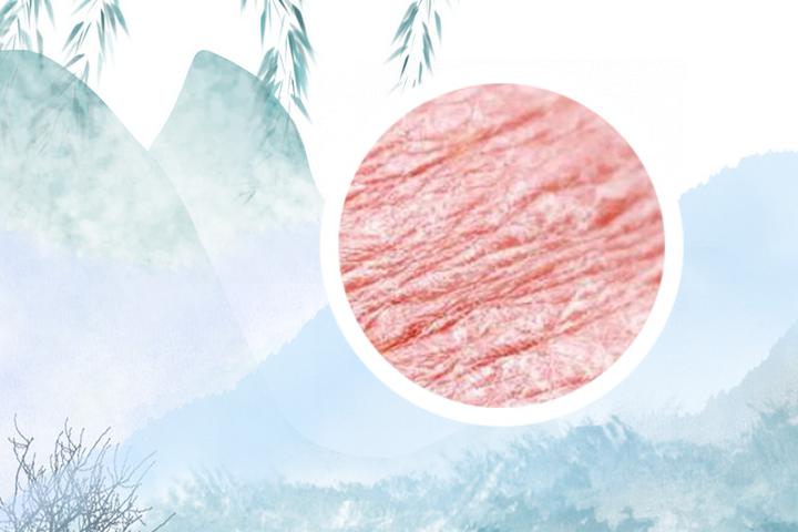 牛皮癣病人能吃地皮菜吗