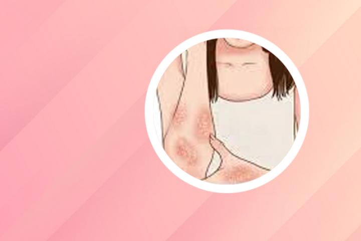 得了银屑病感觉生不如死