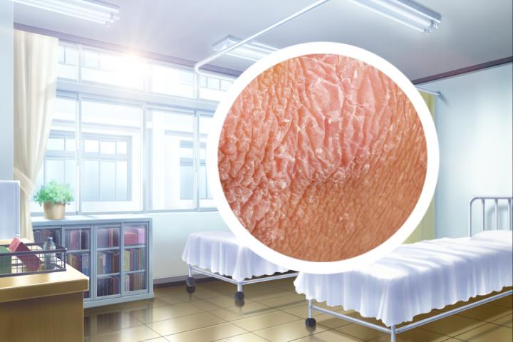 银屑病会遗传给孩子吗