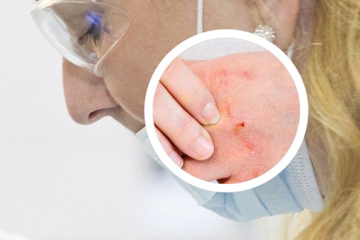 银屑病专用洗发水