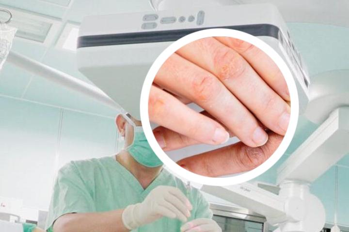 服用银屑病药物后怀孕