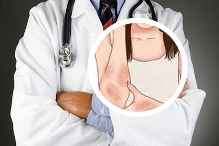 社区学生牛皮癣清理