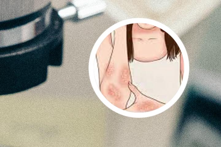 宣传牛皮癣标语