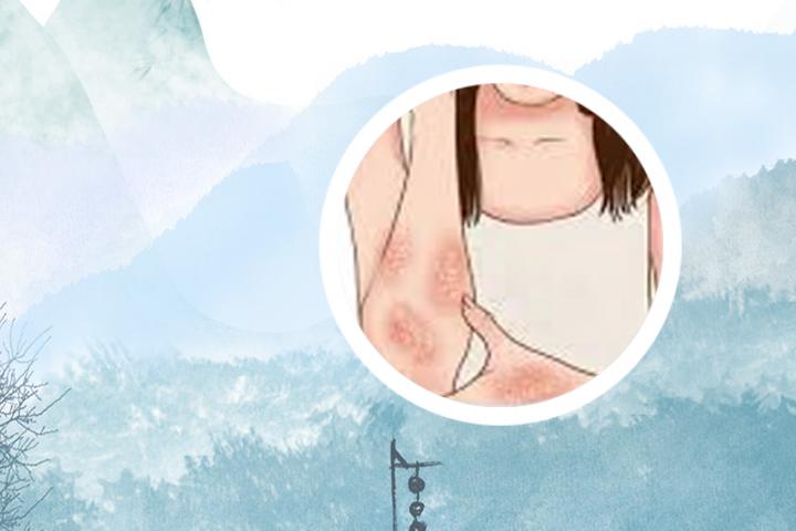 伤寒论对牛皮癣治法