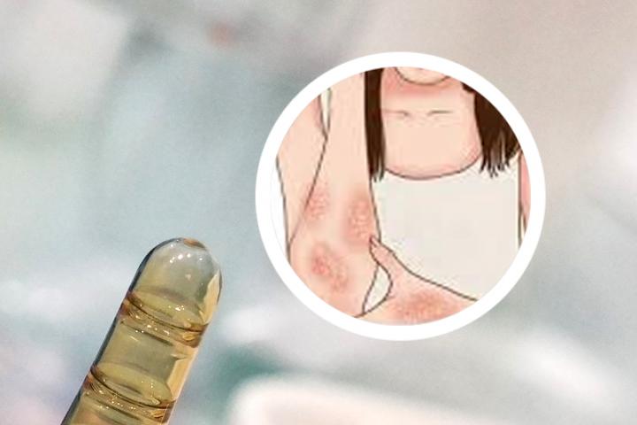 请问济南中研银屑病医院有哪些专家能帮助我治疗