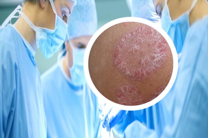 银屑病哪个医院治疗比较好
