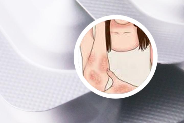 本维莫德药膏牛皮癣