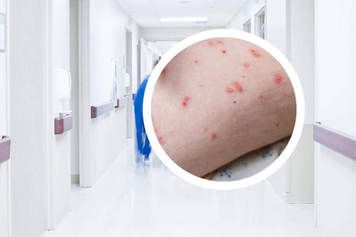 银屑病能用艾草泡澡吗