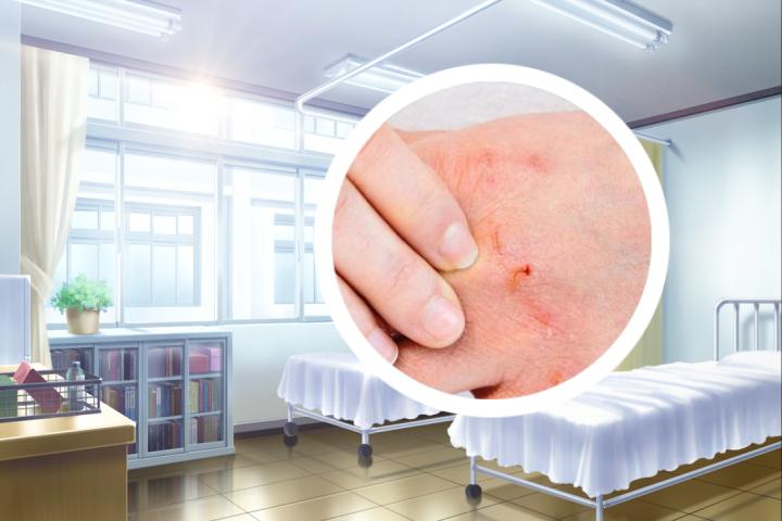 银屑病怎么治才能断根贴吧