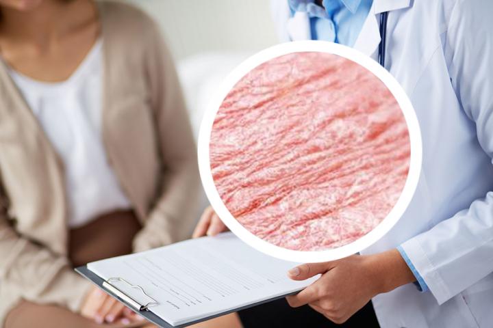 辽源哪家医院能够有效治疗银屑病
