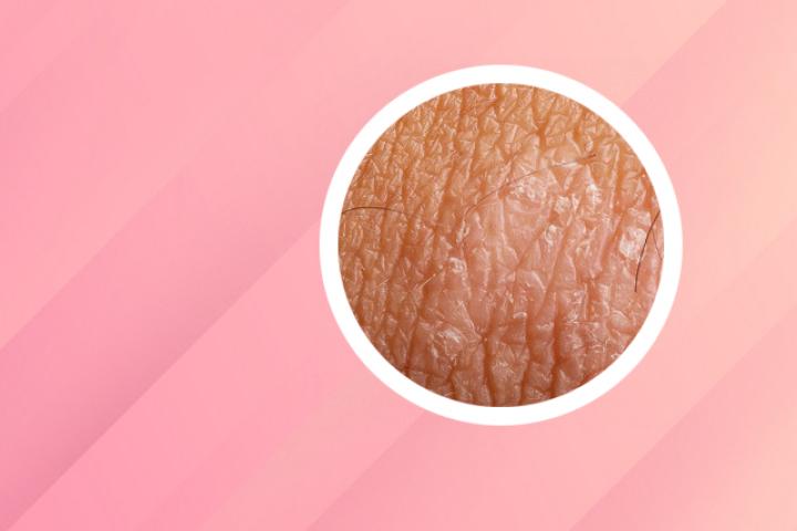 银屑病外用药涂抹顺序视频