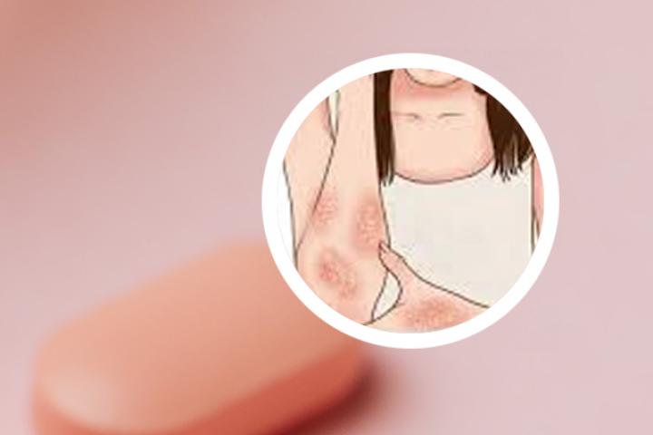 银屑病多吃什么食物好