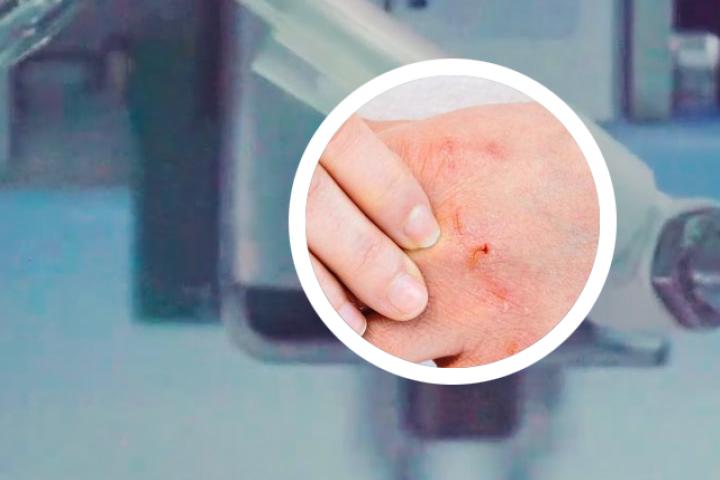 银屑病能上夜班吗