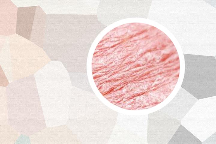 银屑病可以艾灸治疗吗