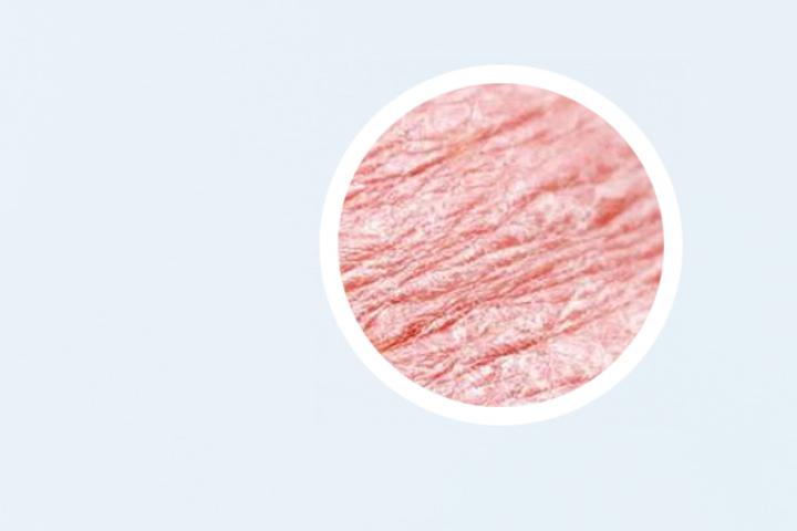 蝎子为什么能治疗牛皮癣
