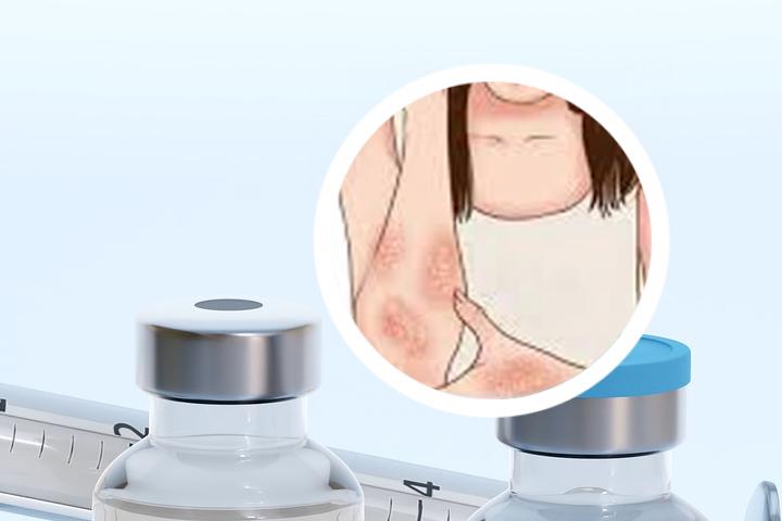 沈阳银屑病治疗中心