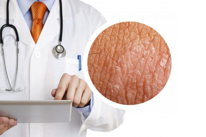 有没有一份完整的银屑病食疗食谱大全
