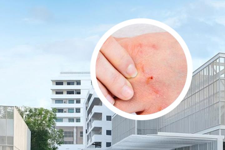 甘肃银屑病最新消息发布