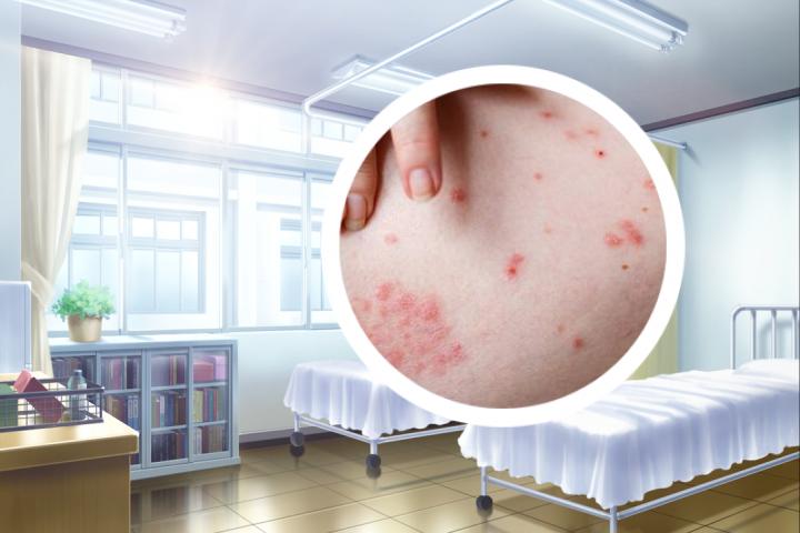 银屑病生物针剂打多久
