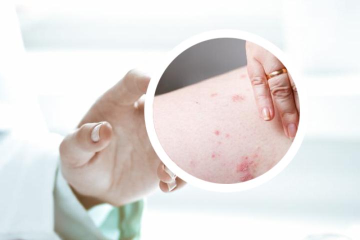 银屑病打生物制剂多久见效