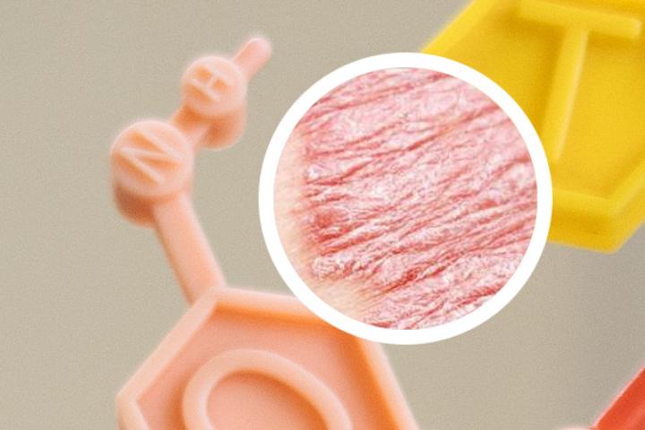 牛皮癣吐鲁番沙子能治疗吗
