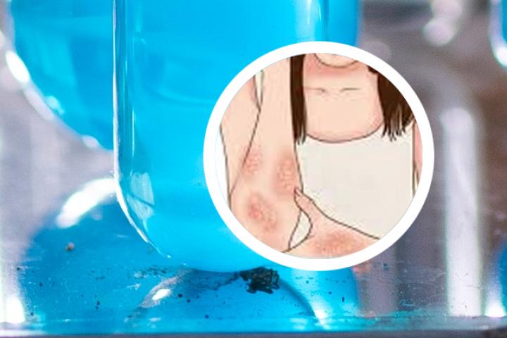 冰片能用于银屑病吗