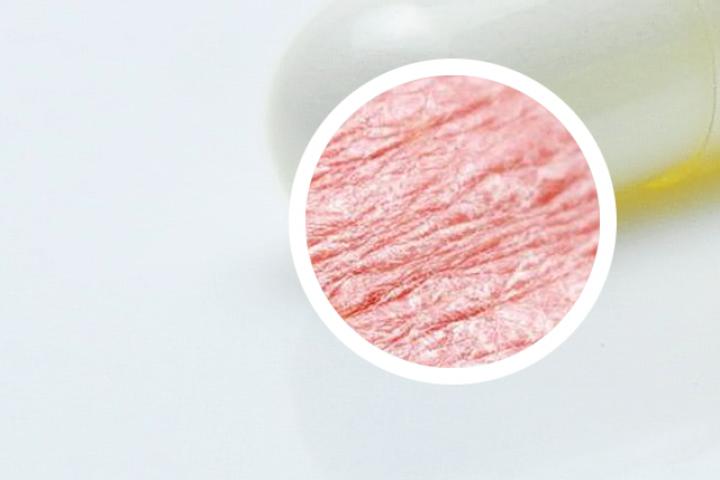 5年的银屑病怎么治好